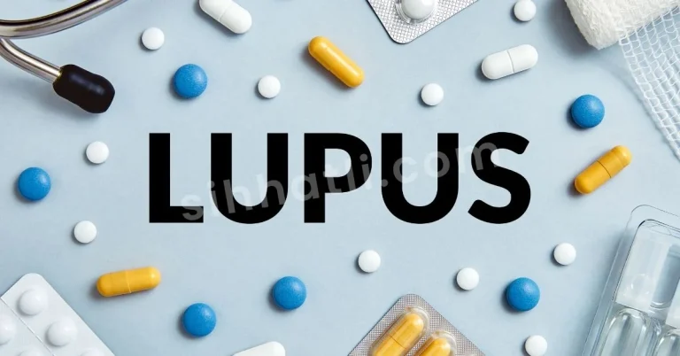 Lupus Nedir